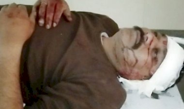 Photo Courtesy: Bhaskar