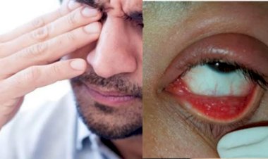 Photo Courtesy: Newsyolo.com 