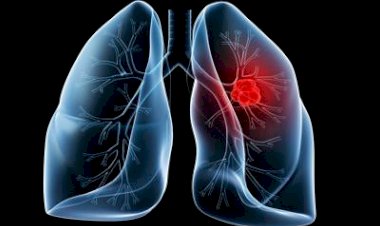 Photo Courtesy: free press journal