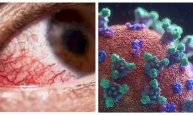 Photo courtesy: Free Press Journal