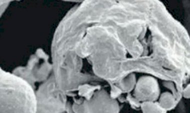 Photo courtesy: amarujala