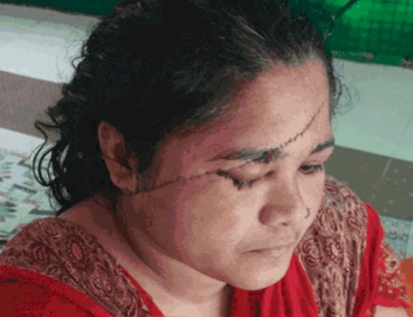 भोपाल में मनचलों का दुस्साहस: महिला पर किया ब्लेड से हमला, 118 टांके लगे, कांग्रेस ने उठाए सवाल
