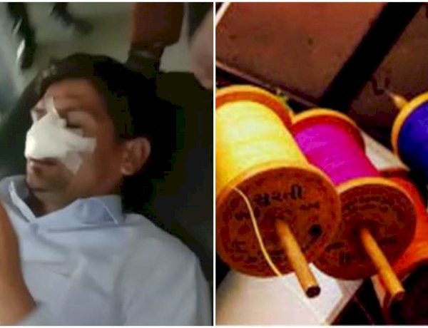 उज्जैन में चाइनीज मांझा से कटी भाजपा नेता की नाक, गंभीर अवस्था में अस्पताल में भर्ती