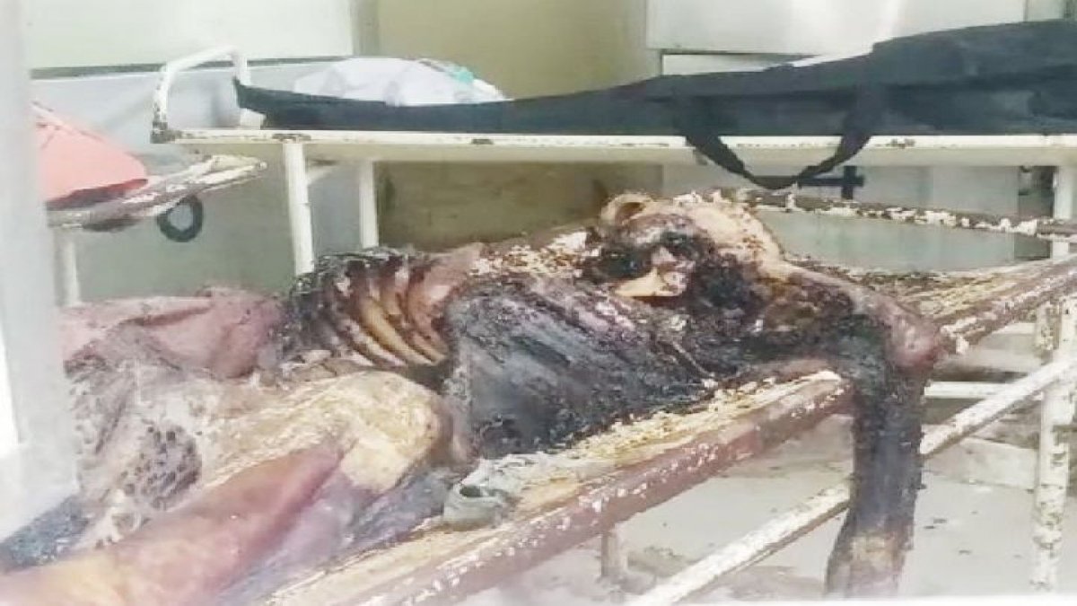 Indore: अंतिम संस्कार के इंतजार में कंकाल बना शव Indore: अंतिम संस्कार के इंतजार में कंकाल बना शव