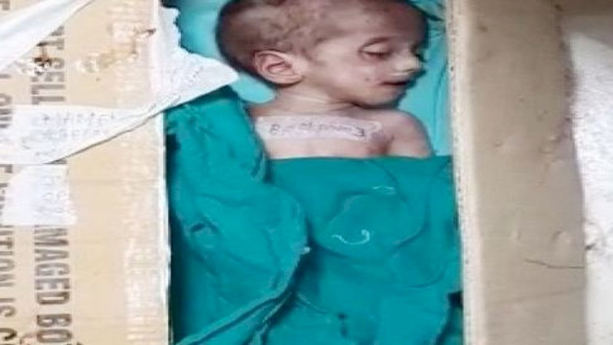 Indore: 5 दिन तक फ्रीजर में पड़ा रहा नवजात का शव Indore: 5 दिन तक फ्रीजर में पड़ा रहा नवजात का शव