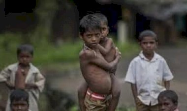 malnutrition in mp. (file photo)