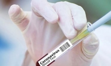 Photo courtesy : twitter