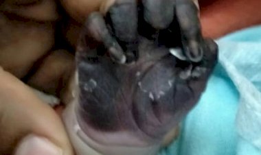 Photo Courtesy: Bhaskar