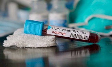 Photo Courtesy: Indian Express 